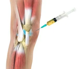 Why PRP for musculoskeletal issues?