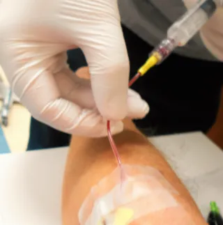 Platelet-Rich Plasma Injection Can Be a Viable Alternative to Corticosteroid Injection