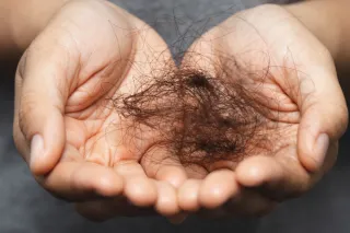 Perimenopause and Hair loss