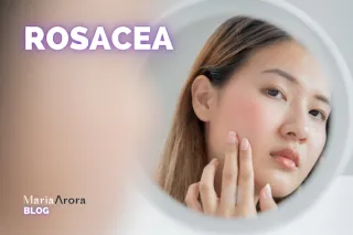 Rosacea