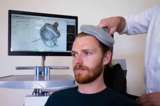 Neuronavegación: Transformando la Precisión en la Aplicación de TMS para Tratamientos Cerebrales Efectivos