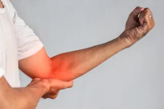 Tennis Elbow (Even if You Don’t Play Tennis): Why It Happens and What Helps