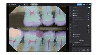 How Preventive Dental Care Powered by AI