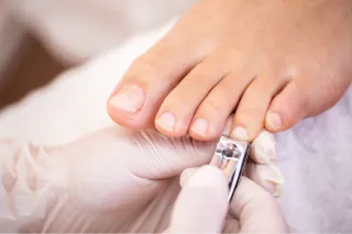 Do You Really Need to Cut Your Toenails Straight?