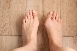 Do Toe Separators and Bunion Splints Really Work?