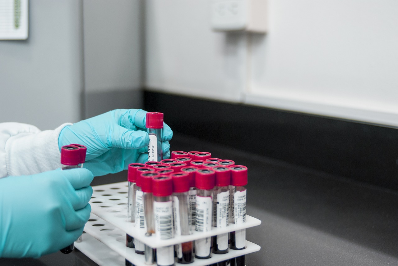 Still Tired? Why a Stress & Hormone Test Could Be the Missing Link