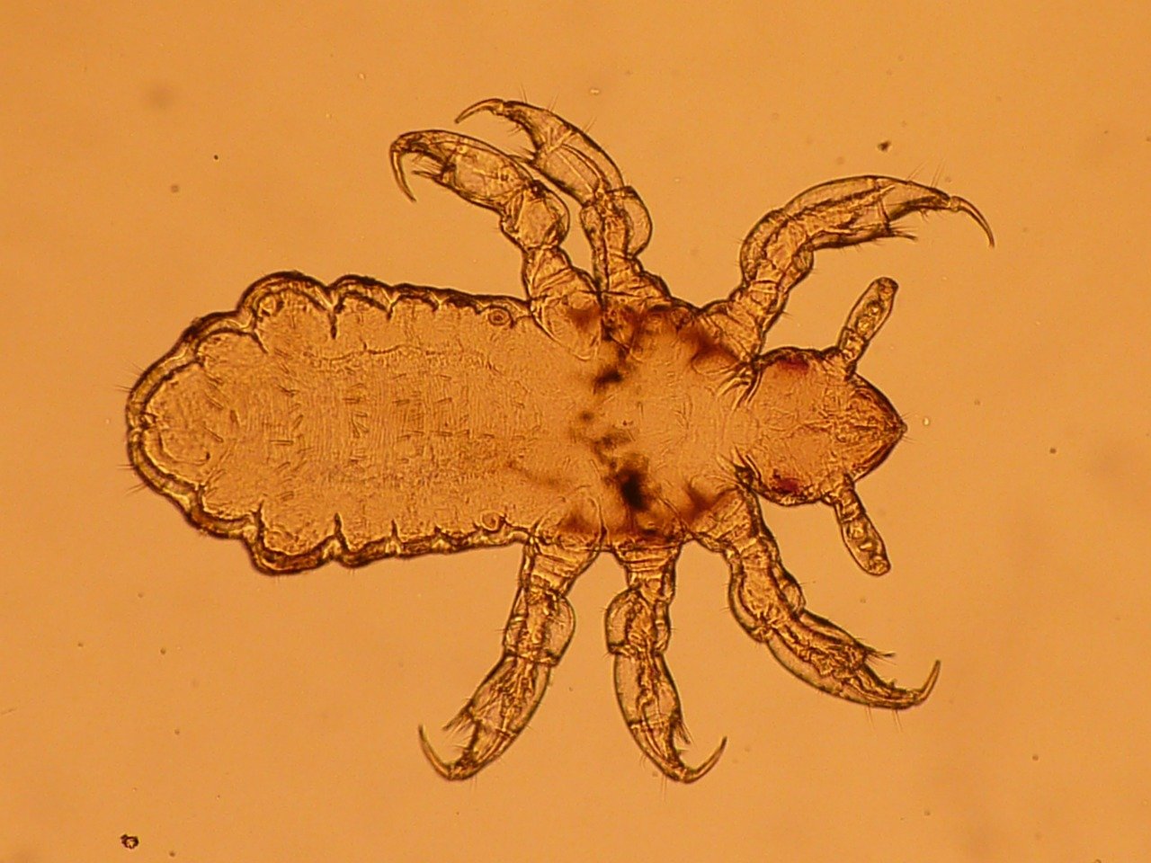 Parasites Port Townsend