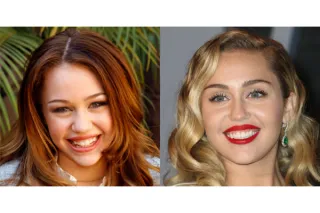 Achieve the Hollywood Smile You Desperately Desire Using Veneers and Smile Away