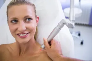 How Much Does Laser Skin Resurfacing Cost in Temecula?