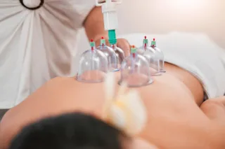 Cupping Therapy for Holistic Pain Relief & Relaxation