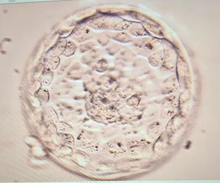 Understanding Embryo Grading