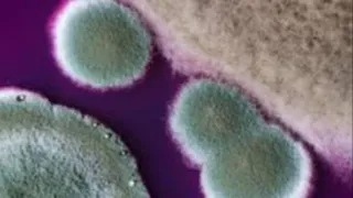 Debunking Mold Myths: Health Risks and Proper Removal