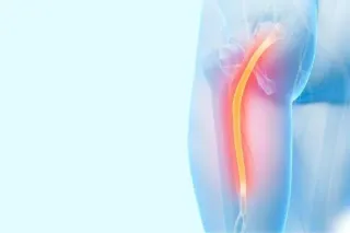 Understanding the Sciatic Nerve: A Chiropractor’s Perspective from London