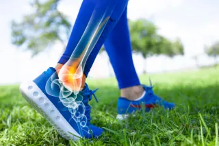 Chronic Ankle Instability After Sprains: Prevention and Treatment Through Chiropractic