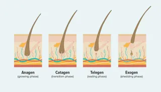 ⏳ How Long Until You See Hair Regrowth? A Realistic Timeline