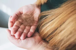 ❗️Think Your Hair Loss Isn’t “Bad Enough” Yet? Here’s Why Waiting Makes It Worse