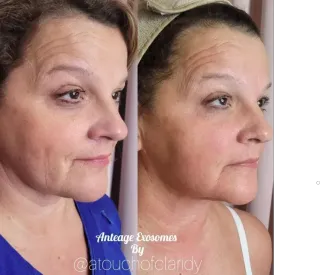 Why Professional Skin Care in Indianapolis Makes All the Difference?