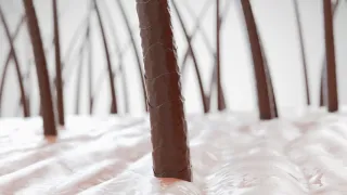 Understanding Postpartum Hair Loss: Causes and SolutionsPost