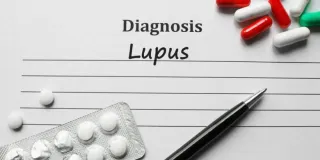 Burial Insurance With Systemic Lupus and With SLE: A Complete Guide

