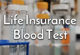 Life Insurance Blood Test