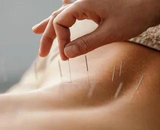 The Benefits of Acupuncture: A Time-Tested Approach to Healing