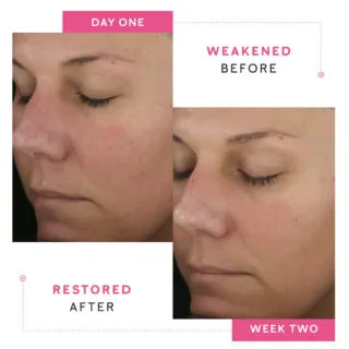 Understanding Barrier Repair: What It Is and Why It Matters for Mature Skin