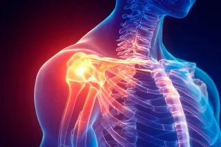 Holistic Shoulder Pain Treatment in Plantation, FL