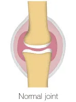 Healthy Joints