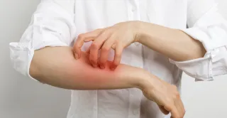 Histamine Overload: Why You Feel Awful and What to Do About It