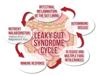 Leaky Gut... What is it? Do you have it? How to heal it!