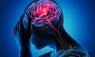 Vestibular Migraine: Migraine is not "Just a Headache"