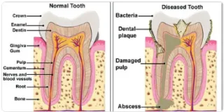 Winter Springs Dentist Near Me: Complete Guide to Services, Costs & Choosing the Best