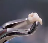 Why One Dentist for the Whole Family Matters