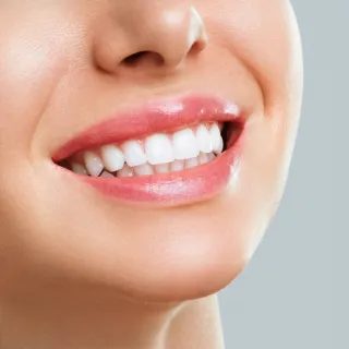 Discover Top Benefits of Choosing a Winter Springs Dentist