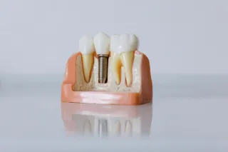 How to Choose the Best Dentist for Checkups