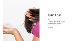 Hair Loss