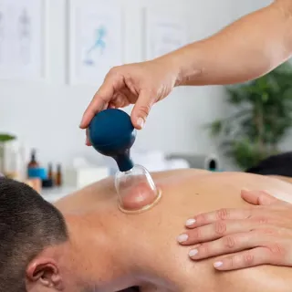 Benefits of Cupping Therapy in Tamarac | Natural Healing
