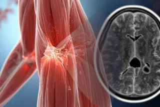 Micro-Tears and Micro-Injuries: The Soft Tissue Damage MRI Still Can’t See