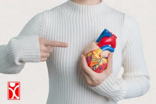 Atherosclerosis Explained: How Plaque Sneaks Up on Your Arteries