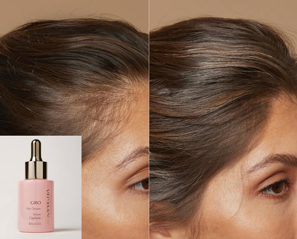 7 Best Hair Serum For Growth Picks To Try In 2025