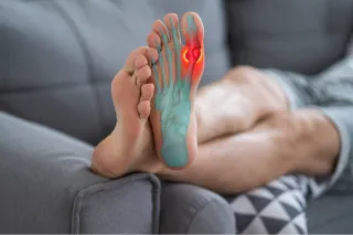 Overcoming Plantar Fasciitis: Strategies for Relief and Recovery