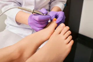 Laser Therapy vs. Topical Treatments: Kicking Fungal Nails to the Curb at Foot & Ankle Associates of Southern NH