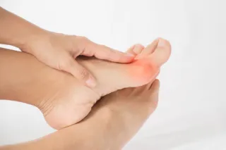 The Role of Orthotics in Bunion Management