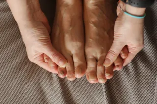 The Role of Toenail Deformities in Fungal Infections: Prevention and Treatment