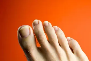 Nail Reconstruction 101: What You Need to Know