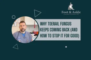 Why Toenail Fungus Keeps Coming Back (And How to Stop It for Good) - Video Clip