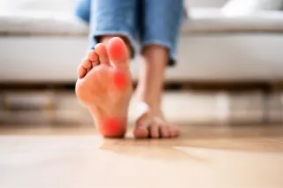 Nerve Pain in Your Feet? Here’s What Might Really Be Going On