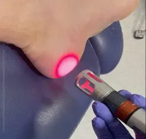 Advanced Podiatric Techniques: Innovations in Foot Care