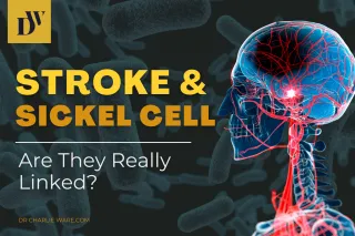 Stroke and Sickle Cell… Are They Really Linked?