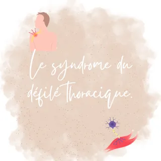 Le syndrome du défilé thoracique